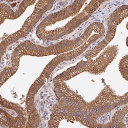 DNA Polymerase gamma Antibody, Novus Biologicals:Antibodies:Primary Antibodies